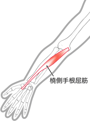 橈側手根屈筋