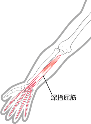 深指屈筋