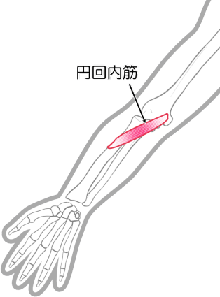 円回内筋